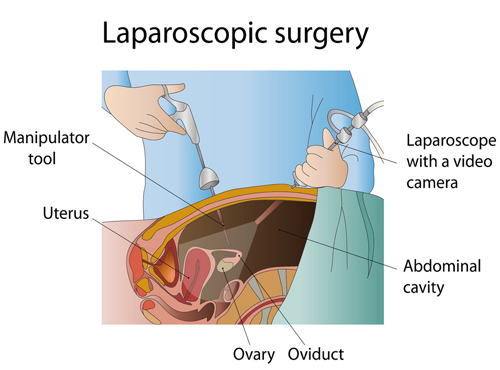 Gynecologist in Jaipurt