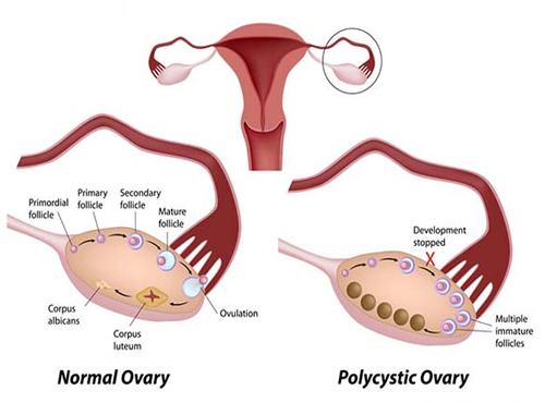 Gynaecologist